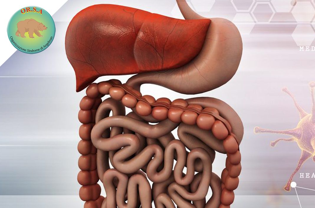 Prevalenza Sintomi Gastrointestinali nella Sindrome di Angelman | OR.S.A. Organizzazione Sindrome di Angelman